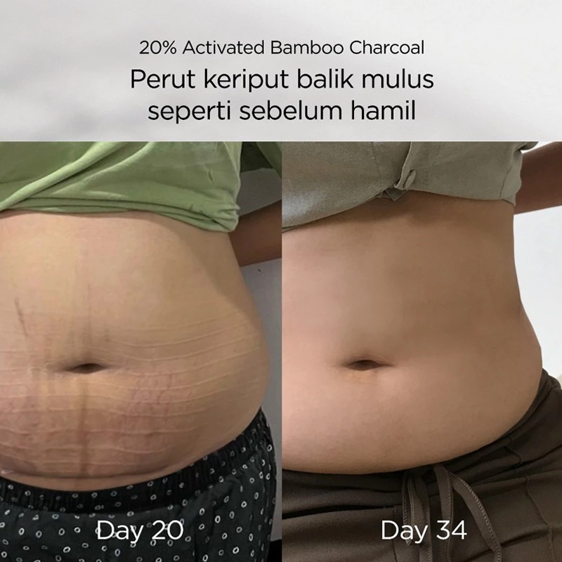 onlife korset postpartum bamboo / korset bamboo pasca melahirkan